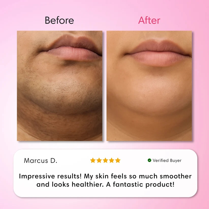 Glassline Vanish - 3 Step Hair Removal System