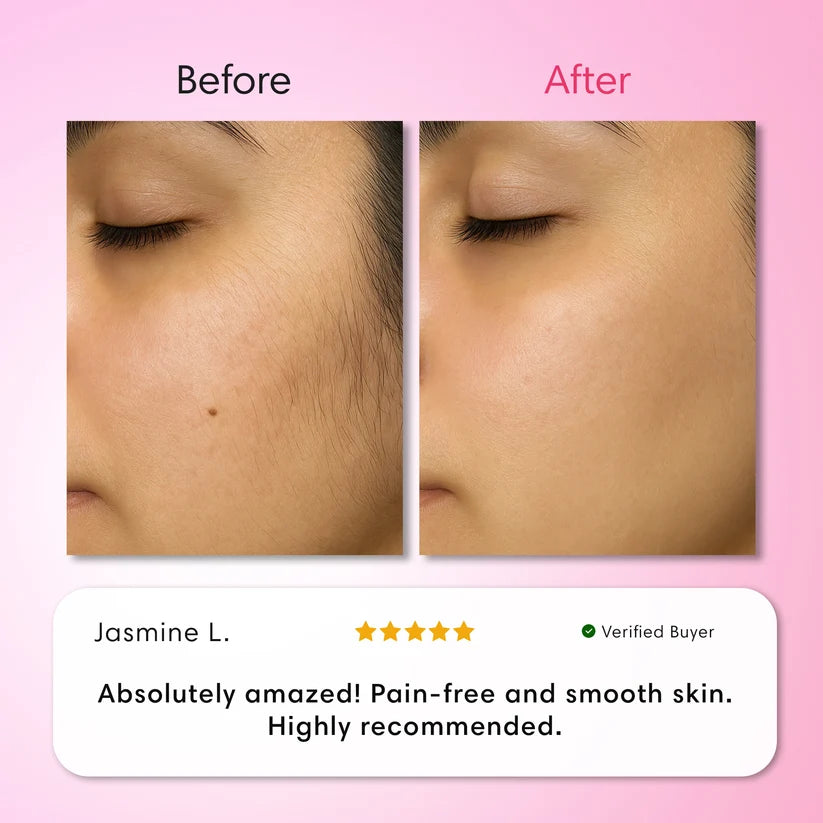 Glassline Vanish - 3 Step Hair Removal System