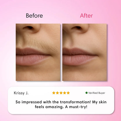 Glassline Vanish - 3 Step Hair Removal System
