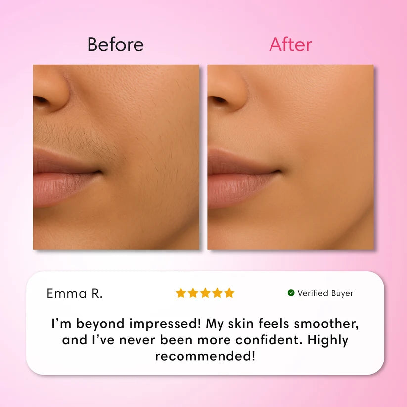 Glassline Vanish - 3 Step Hair Removal System