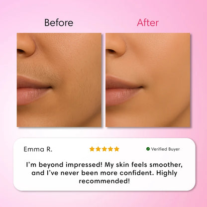 Glassline Vanish - 3 Step Hair Removal System